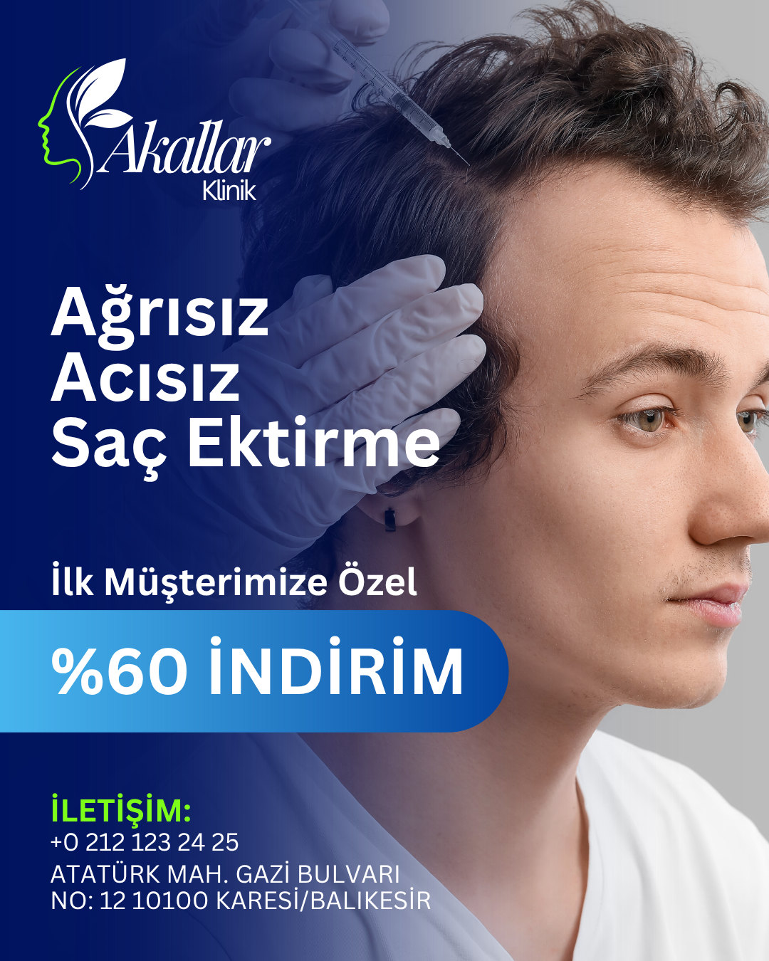 Saç Ektirme